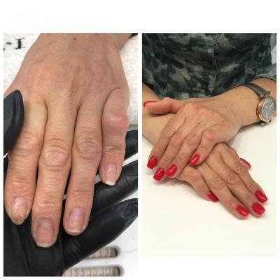 Nails 10